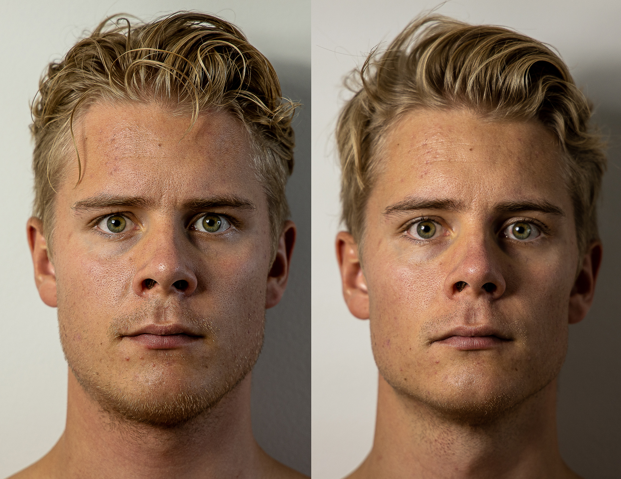 water fasting before and after 7 days